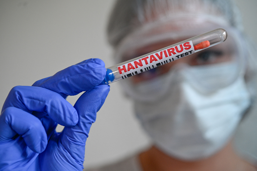 ILLUSTRATION of laboratory hantavirus testing concept with sample tubes and cotton swabs handled by a person wearing protective medical equipment photographed in Paris, France, May 8, 2026.