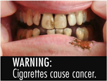 "Cigarettes cause cancer"