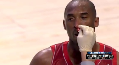 Los Angeles Lakers guard Kobe Bryant suffered a broken nose due to a hard foul from the Miami Heat's Dwyane Wade during the All-Star game matchup on Feb. 26, 2012.