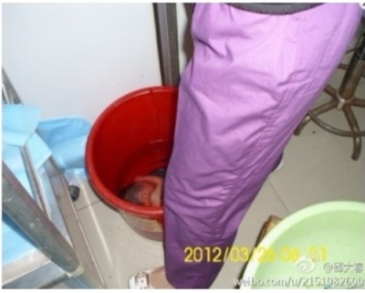 This photo is said to show a nine-month fetus forcefully aborted and floating in a bucket in a hospital in Moshan, China on March 26, 2012.