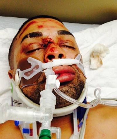 Biker, Edwin Mieses Jr. is in a coma after he was run over by Manhattan executive, Alexian Lien, 33.