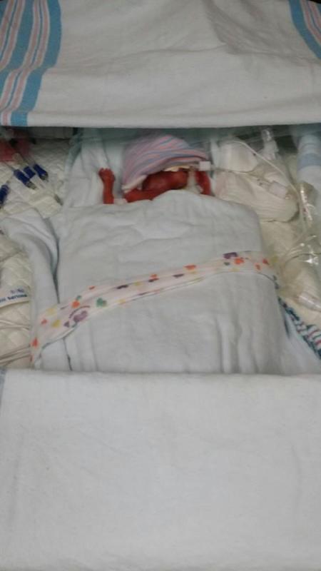 Decklen James Maize, born at 22 weeks.