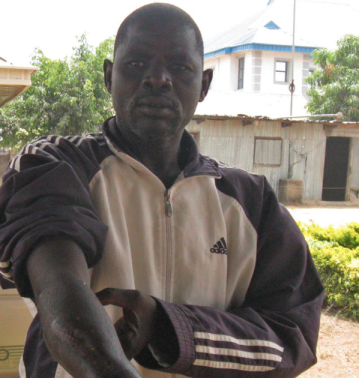 Scars on Adamu Musa, shot by Boko Harm in attack on I Gava West village, Gwoza, Borno state in 2013.