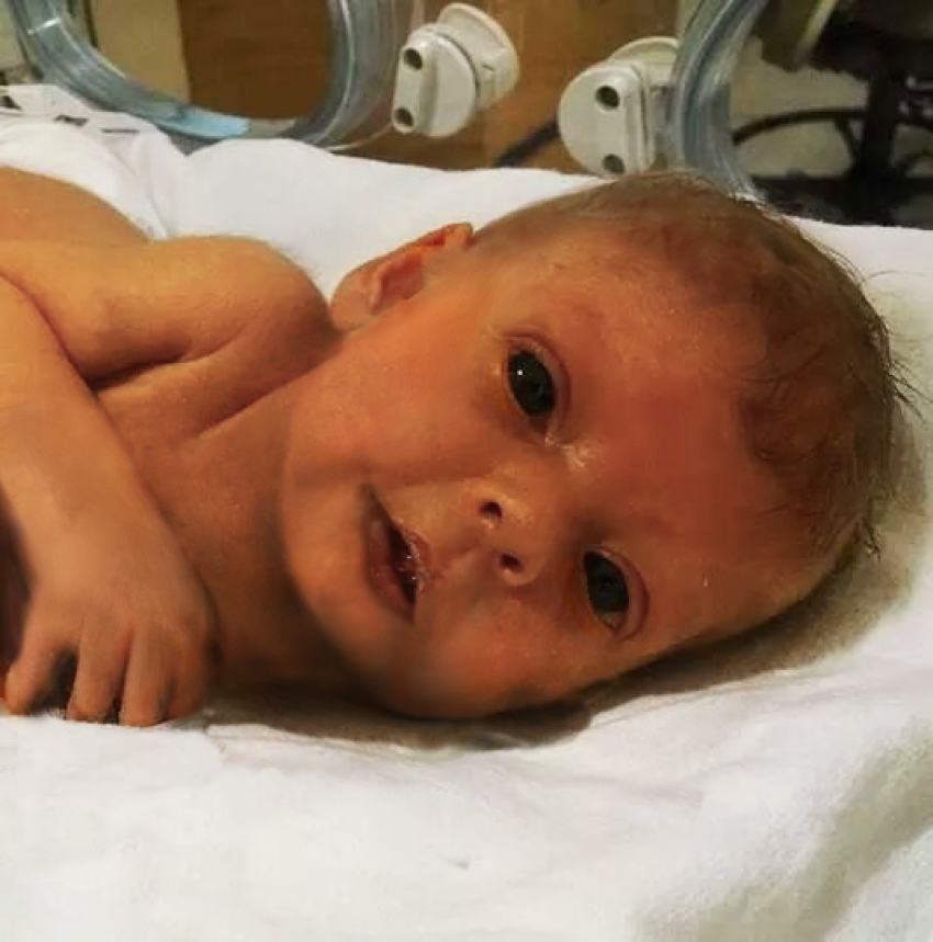 Credit : (Photo: tacothecat/imgur via reddit)