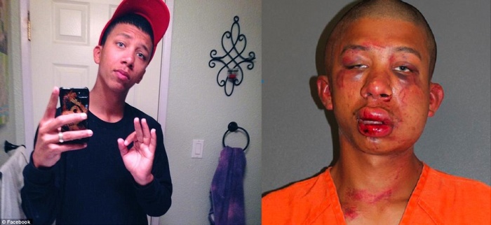 Raymond Frolander, 18, before and after Jason Browning's beating for molesting his son.