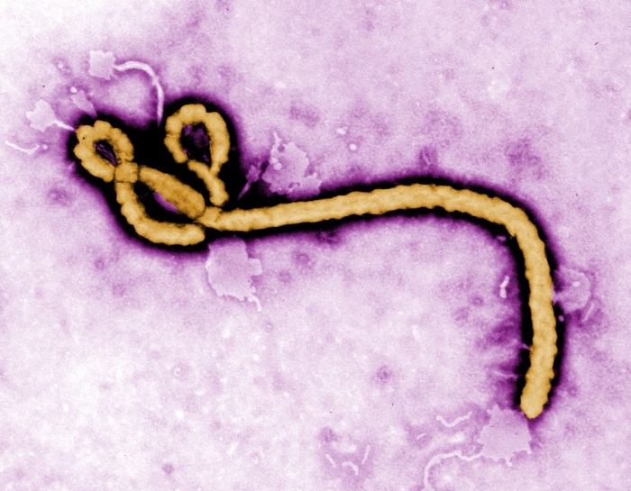 Some of the ultrastructural morphology displayed by an Ebola virus virion is revealed in this undated handout colorized transmission electron micrograph obtained by Reuters August 1, 2014. The 2014 Ebola outbreak is the worst since the disease was discovered in the mid-1970s, with 729 deaths in four different countries.