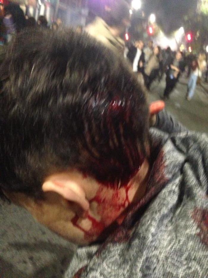 Cindy Pincus posted this photo of her head split open after an encounter with police in Berkeley, California.