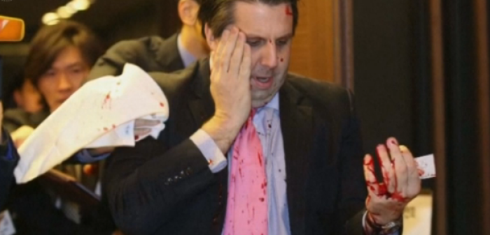 U.S. Ambassador to the Republic of Korea, Mark Lippert, whose face and arms were slashed with a knife by a protester on March 4, 2015, in Seoul, South Korea.