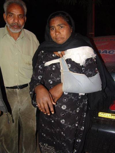 Aysha Bibi's arm was broken in a beating conducted by Pakistani police.