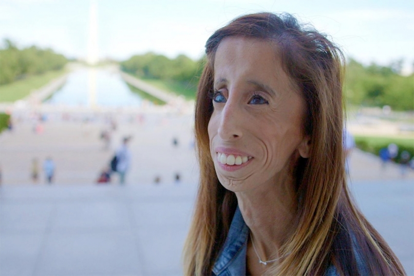Anti-bullying activist Lizzie Velasquez released a new documentary "A Brave Heart: The Lizzie Velasquez Story"