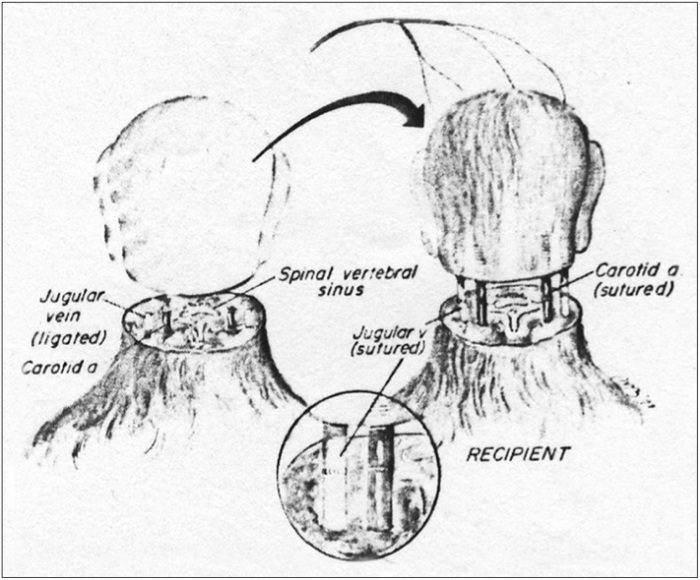 Illustration of head transplant in a monkey (White et al 1971)