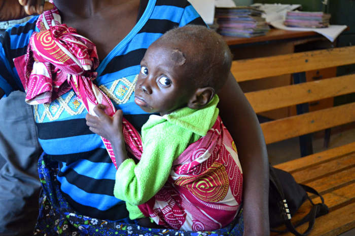 A young child looks on while his mother speaks with a nurse at the Moyo ADP Health Center in Southern Zambia on March 25, 2015.