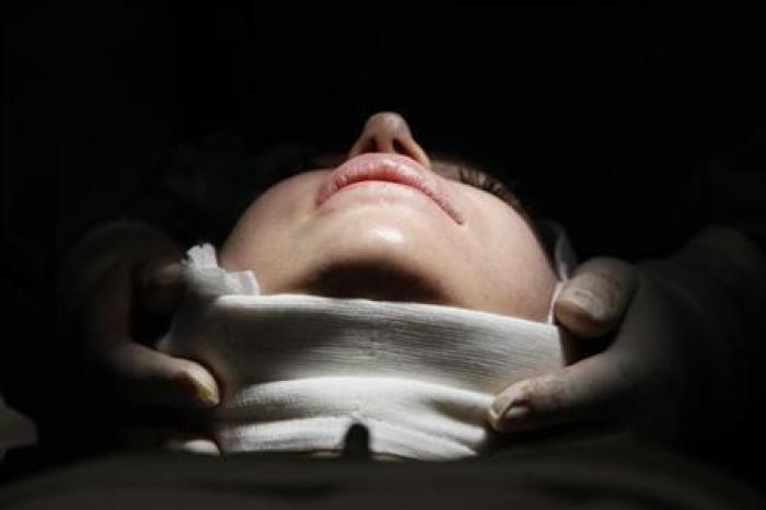 A woman lies on an operating table during a facelift surgery at a private plastic surgery clinic in Budapest, Hungary, March 1, 2012.