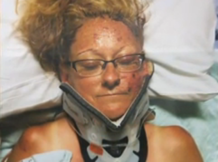 Pamela Beckham suffered a broken neck when she was hit by a car driven by Marilyn Perry in August 2014.