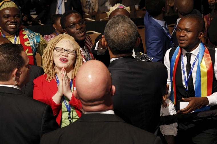 A young woman reacts after shaking hands with U.S. President Barack Obama after his remarks at the Young African Leaders Initiative Mandela Washington Fellowship Presidential Summit in Washington, August 3, 2015. Obama addressed discrimination against African sufferers of albinism during his remarks.