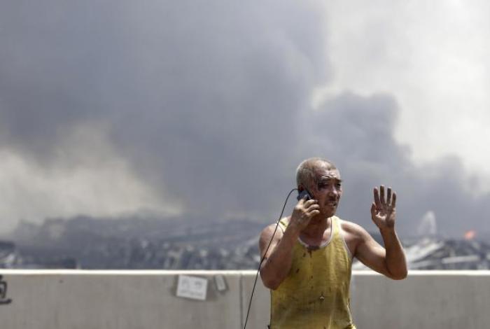 An injured man talks on his mobile phone at the site of the explosions at the Binhai new district in Tianjin August 13, 2015.