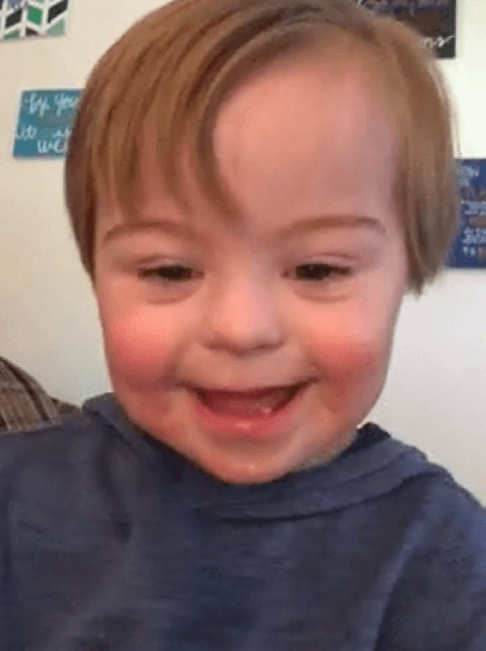 Little kid with Down Syndrome recites alphabet.