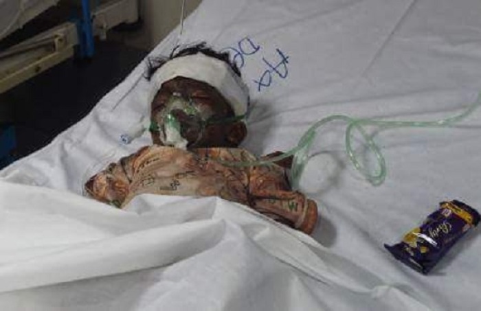 Child receiving treatment following the Easter Sunday, March 27, 2016, bombing in Lahore, Pakistan.