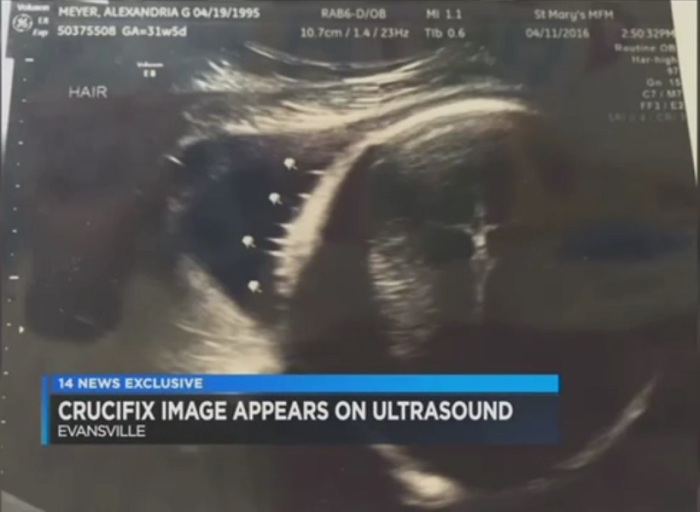 A sonogram of Aley Meyer's baby boy appears to show an image of Jesus on the cross, with video posted on April 20, 2016.