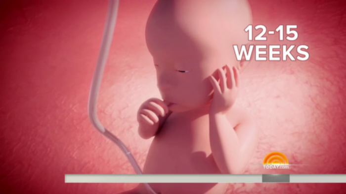 NBC's 'Today Show' episode shows simulation of fetus at 12-15 weeks sucking his thumb. July 31, 2014.
