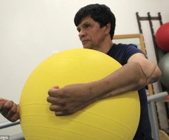 Mexican Man Gets New Grip on Life With First Successful Double Arm Transplant in Latin America (Watch)