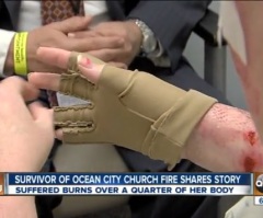Survivor of Maryland Church Fire Speaks Out After Suffering Third-Degree Burns