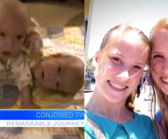 Born Conjoined Twins, Now They're Co-Valedictorians - See the Inspiring Story of Caitlin and Emily Copeland (VIDEO)