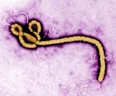 CDC Confirms First Case of Ebola in US as Patient Is Diagnosed With Deadly Virus in Texas Hospital