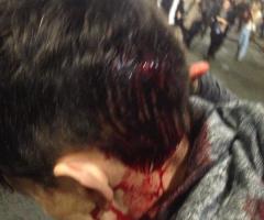 Minister's Head Split Open by Police While Leading Peaceful Protest in California
