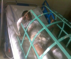 Police Deny Slain Pakistani Christian Boy Recorded Statement Saying He Was Burned for His Faith; Video Reveals His Testimony Was Given (Watch)