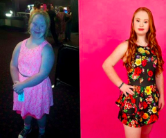 Girl With Down Syndrome Becomes a Model and Sends a Powerful Message to Those Who Doubted Her