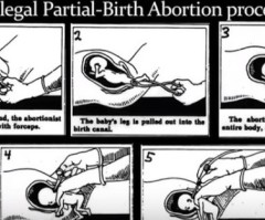 Planned Parenthood Training Staff to Perform Illegal Partial-Birth Abortions?