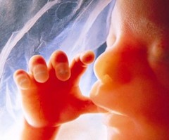 Why Is NARAL Fearful of Ultrasound Technology Showing Baby in Womb?