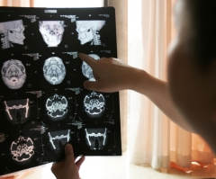 Doctor in China to Perform First-Ever Human Head Transplant Surgery