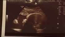 Sonogram Shows Jesus Watching Over Baby in Womb, Pennsylvania Couple Says