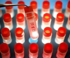 Scientists Develop New Method to Create Stem Cells Without Killing Human Embryos