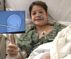 Family Praises God for 'Miracle' After 10-Y-O Boy Survives Being Impaled in Face by Meat Skewer