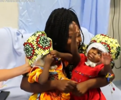 Conjoined twin sisters looked at each other for first time after Vatican hospital operation