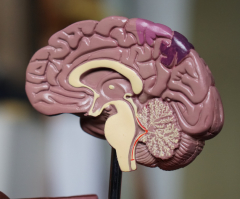 Christian neurologist details ethical parameters of brain-reading technology