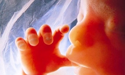 Compassionate care will turn the tide of abortion