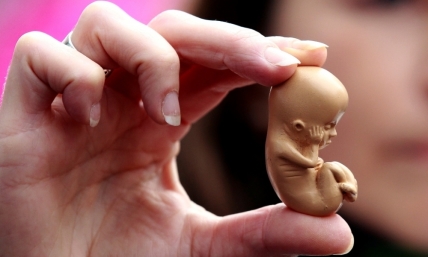 Why abortion is a Gospel issue