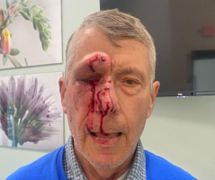 Pro-life activists assaulted outside Maryland abortion clinic, suspect remains at large