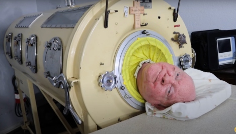 Paul Alexander, confined 72 years in iron lung, spoke of 'God's love' before death