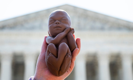 Abortions on the rise since Roe reversal thanks to abortion pill spike: report