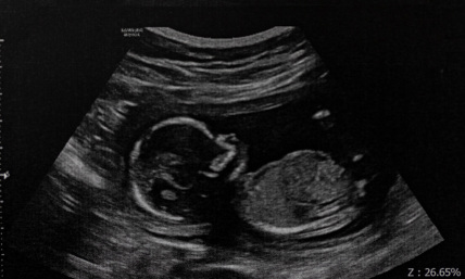 An encouraging pro-life victory