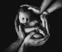 Diagnosis isn't destiny: A Pompe disease survivor on selective abortion