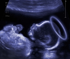 Jesus Ultrasound Poster Fuels U.K. Abortion Uproar