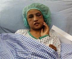 Afghan Girl Tortured by In-Laws, Karzai Calls for Investigation