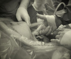 Viral Photo: Baby Grabs Doctor's Finger While in Womb
